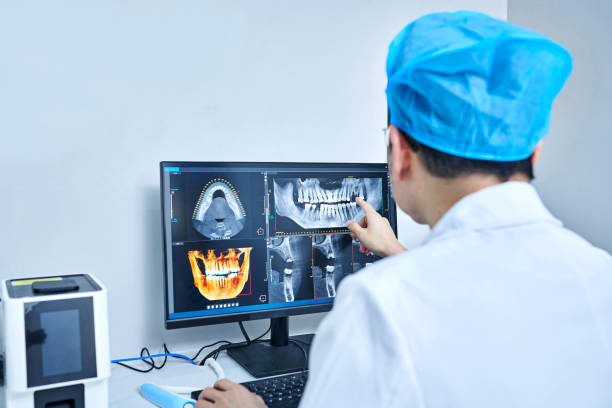 Best Emergency Wisdom Tooth Extraction in Pine Beach, NJ
