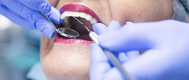 Best Knocked-Out Tooth (Avulsed Tooth) Treatment in Pine Beach, NJ
